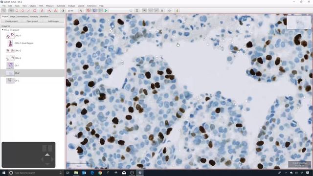 1 - Introduction to QuPath for IHC analysis смотреть онлайн
