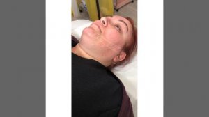 Jaw contouring fat dissolve with Lipo-lab V-Line