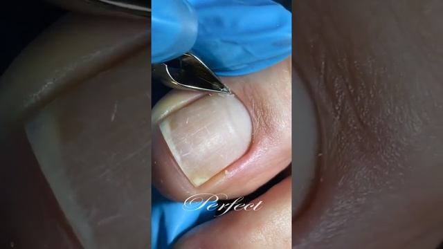 Обработка ногтевой пластины в педикюре. Идеальное покрытие. смотреть онлайн