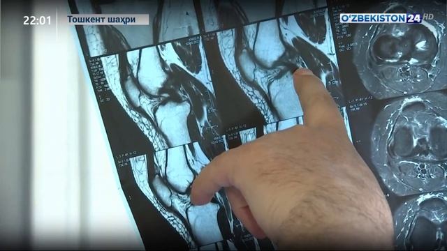 Травматология ва ортопедия илмий-амалий тиббиёт марказида жарроҳлик амалиётлари