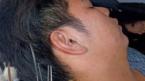 убираем серу из ушей