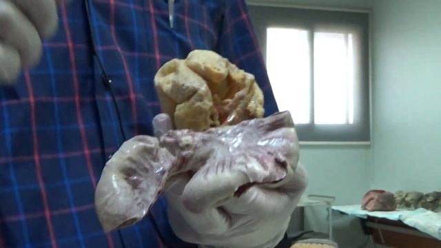 GIT W5 Lab2 - Anatomy of large Intestine and Small intestine with relations смотреть онлайн