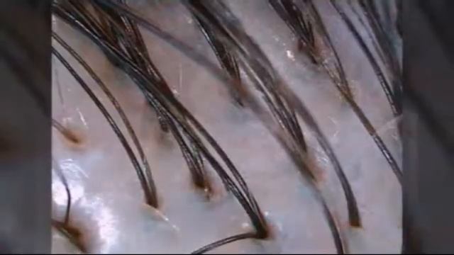 Топ 10 снимков под микроскопом смотреть онлайн