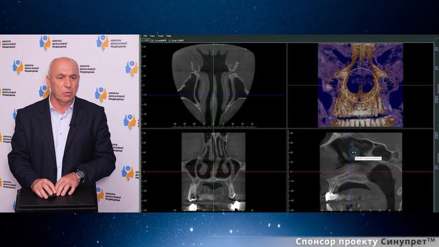 Можливості КПКТ в діагностиці патології приносових пазух смотреть онлайн