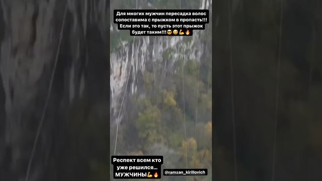 А чем вы занимаетесь в перерывах между пересадками волос? #пересадкаволос #пересадкабороды #втопе