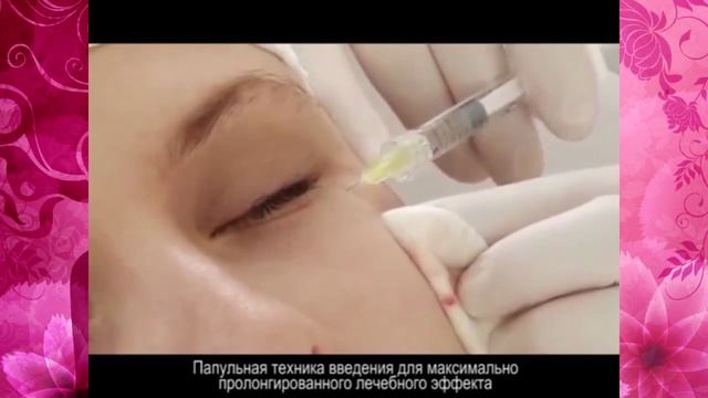 Инъекции гиалуроновой кислоты для омоложения кожи Томилова А А смотреть онлайн