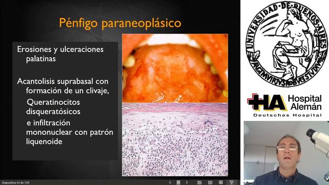Patología II - Piel - Dermatitis vésicoampollares смотреть онлайн