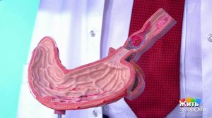 Совет за минуту: как лечить гастрит? Жить здорово! Фрагмент выпуска от 29.05.2018