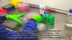 Метастазы в печени: прогноз продолжительности жизни