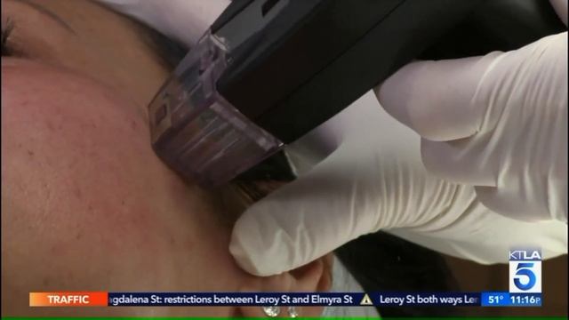 Morpheus8 by InMode - HOW IT WORKS смотреть онлайн