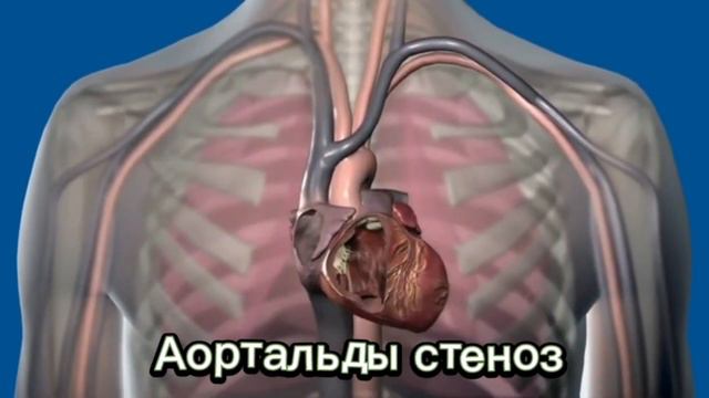 ЖҮРЕК ТОНДАРЫН ТЫҢДАУ . Жүрек ақауларындағы тондардың ерекшелігін ажырата білу. Жүрек аускультацияс смотреть онлайн