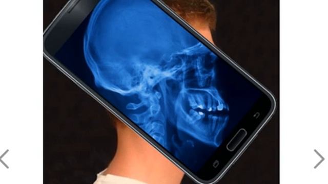 Мобильное приложение Рентген