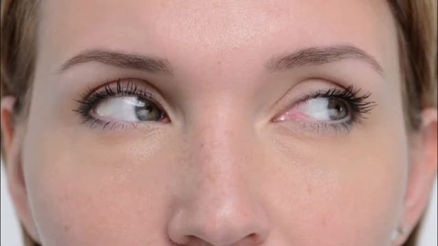 Oblique Capitis Inferior Dry Needling смотреть онлайн