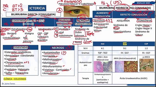 Hepatopatía - Ictericia, Psudoictericia смотреть онлайн