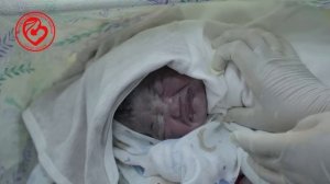 KESIR KESISH JARAYONI VA ONA BOLA BILAN BIRINCHI UCHRASHUVI КЕСИР КЕСИШ ЖАРАЁНИ #uzbekistan #kesir