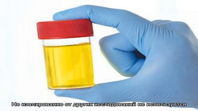 Показатели анализа мочи при простатите смотреть онлайн