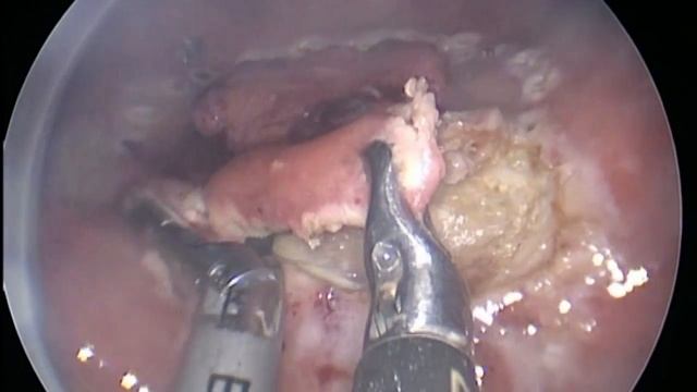 Хирургия без разрезов смотреть онлайн