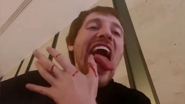 VJLink РАЗБИЛ СТАКАН ОБ ГОЛОВУ