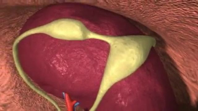 Cancer ravages the lymph nodes: Lymphoma смотреть онлайн