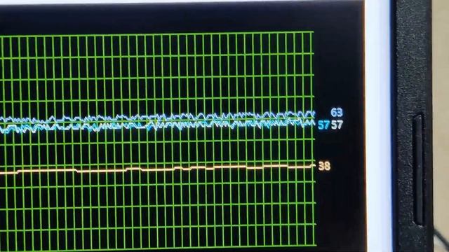 Acer Nitro 5 (AN515-55) - перегрев! Решение проблемы смотреть онлайн