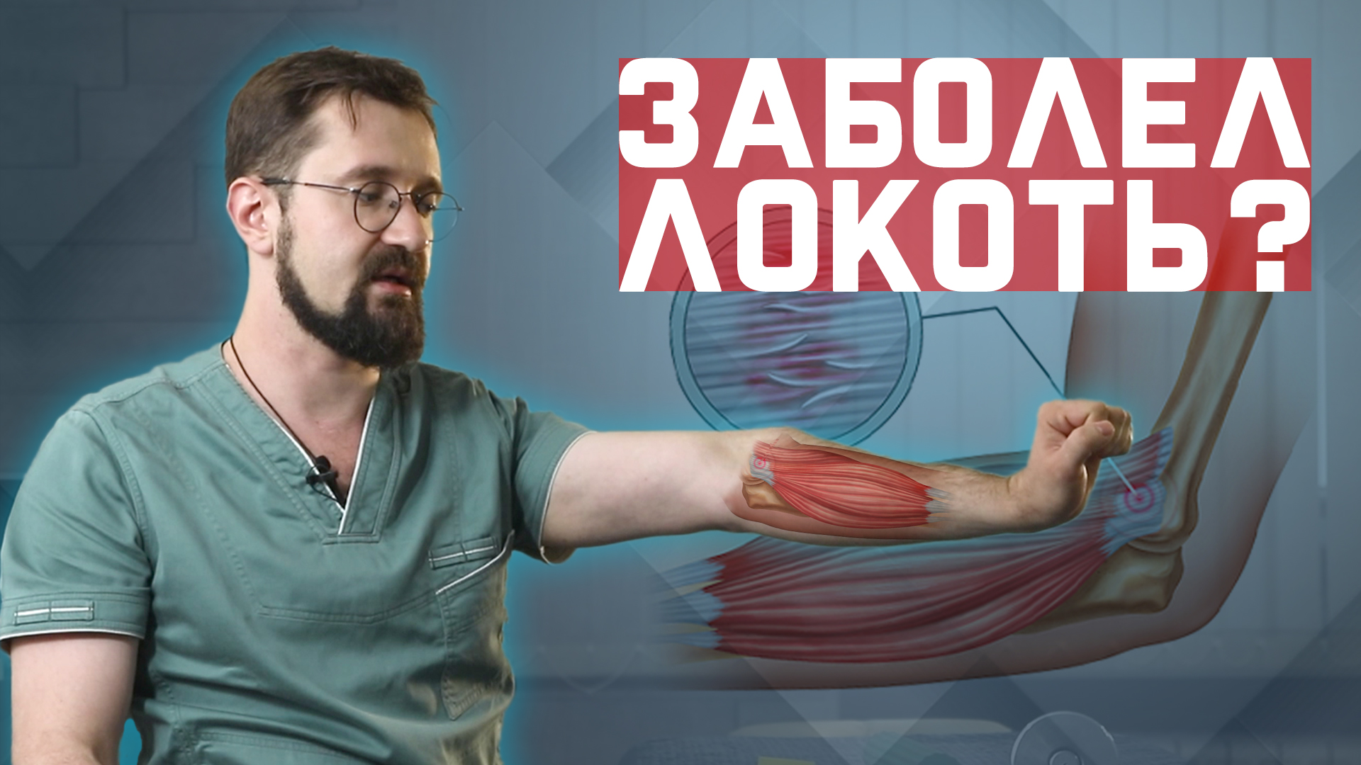 Что делать, если заболел локоть? Латеральный эпикондилит.