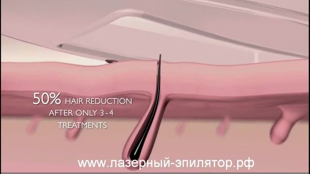 Презентация светового эпилятора Silkn Glide смотреть онлайн