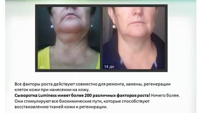 Старение кожи  Как остановить СТАРОСТЬ! 100% результат!