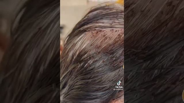 Вши съели голову смотреть онлайн