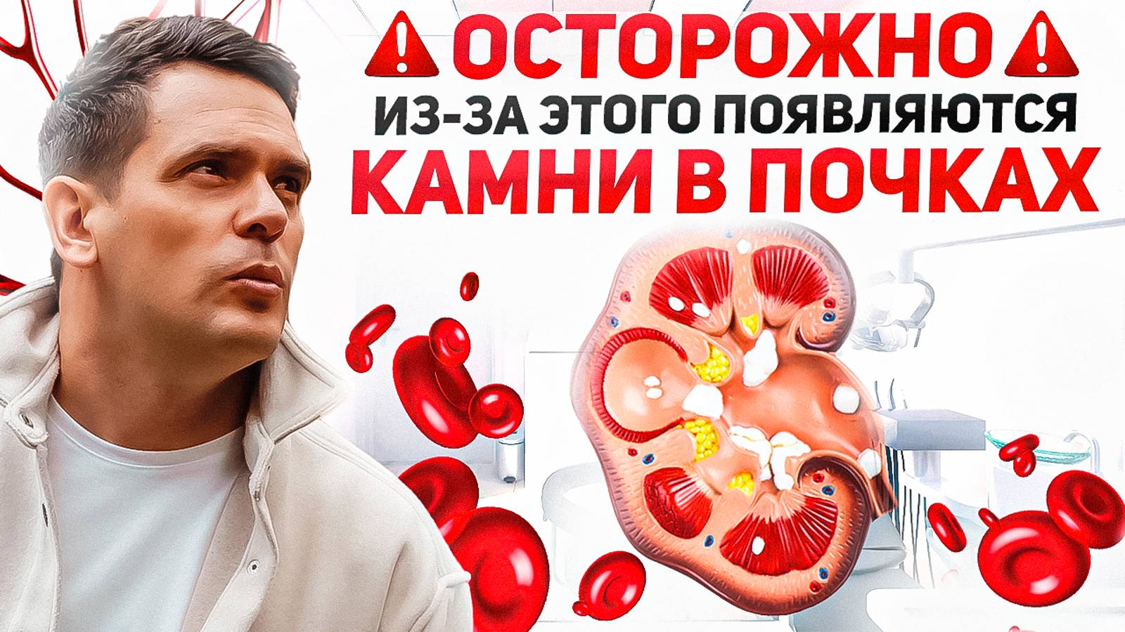 Главная Причина Камней в Почках. Как Их Не Допустить и Избавиться навсегда? смотреть онлайн