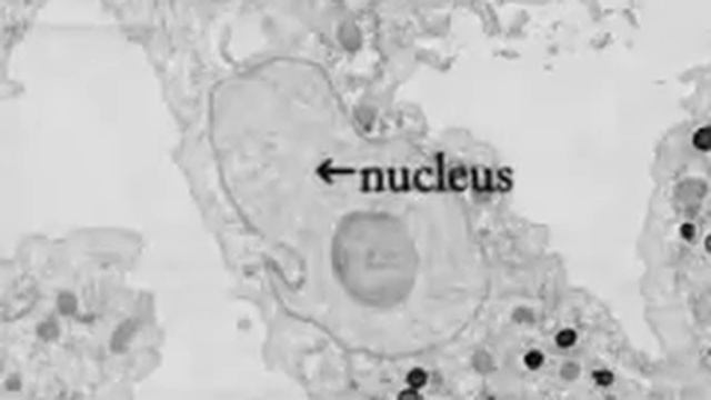 Pithovirus sibericum A new Giant Virus from Siberia смотреть онлайн