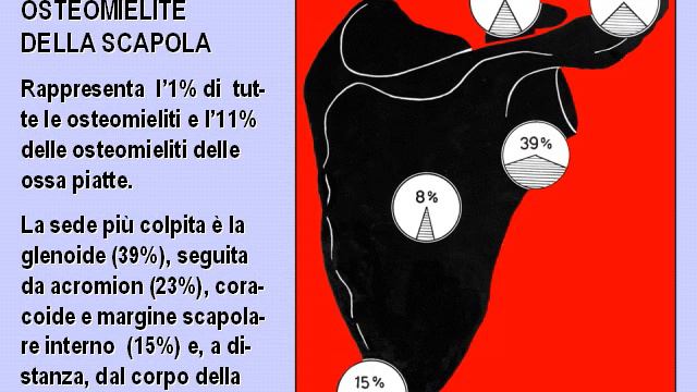 Z40b Malattie infiammatorie Osteomielite dell'iinfante e dell'adolescente 133 12 17 15 04 wmv смотреть онлайн