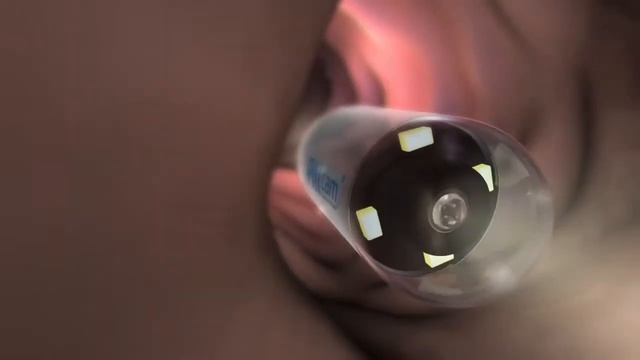 PillCam ESO 2 3D Animation смотреть онлайн