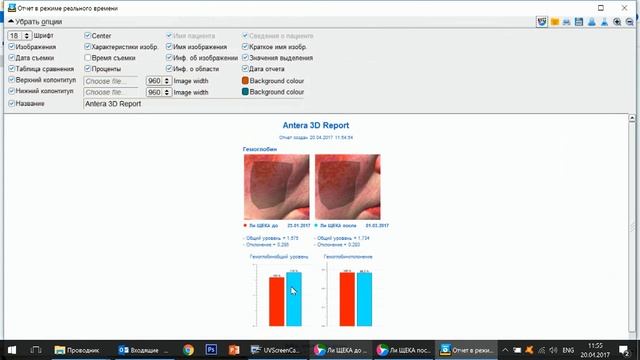 Antera 3D обучающее видео 17 составление отчетов Пример 2 смотреть онлайн