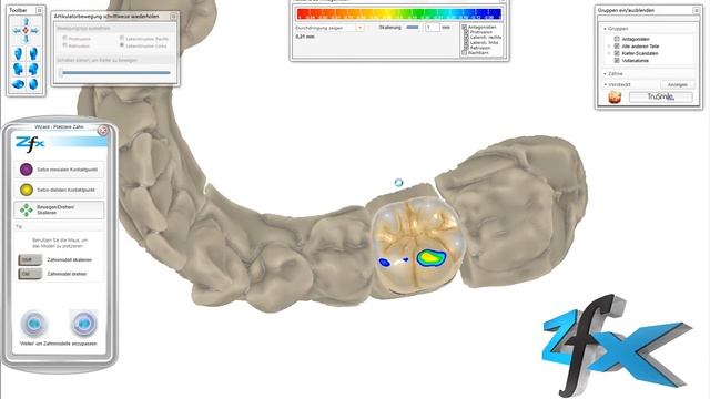 Zfx CAD Software - Virtual Articulator смотреть онлайн