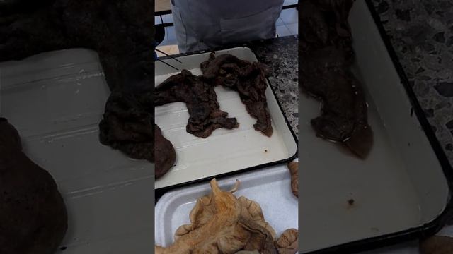 поджелудочной желез смотреть онлайн