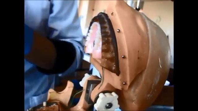 Препарирование зубов под металлическую, штампованную и пластмассовую коронку смотреть онлайн