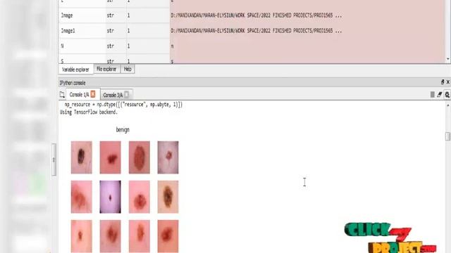 Python Image Processing - Skin Cancer Detection using Deep Learning - ClickMyProject смотреть онлайн