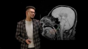 Ликворная система мозга