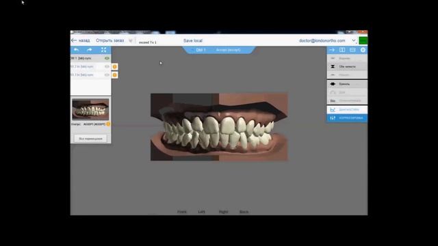 Exceed - программа для ортодонта
