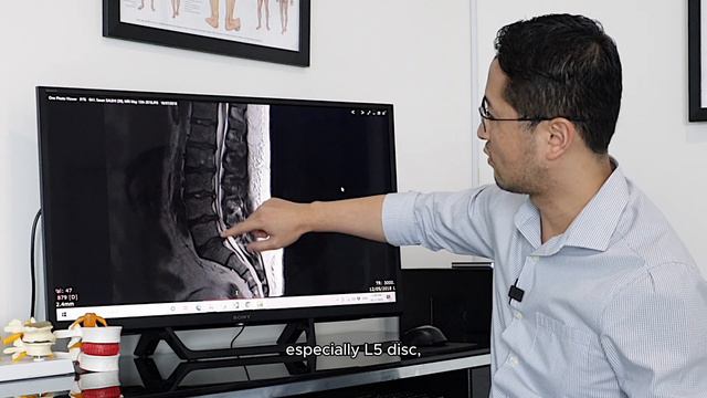 Can Gonstead Chiropractic help you avoid surgery? смотреть онлайн