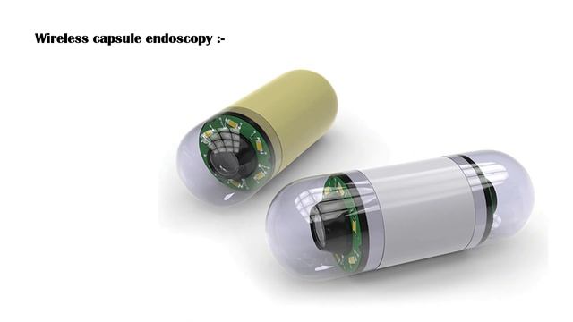 Endoscopic Procedure - Indications, Types, How It Is Done, Risks, And Complications смотреть онлайн
