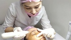 #Лазерная ручка для удаления #Пигментных пятен #Жеровике #Бородавок