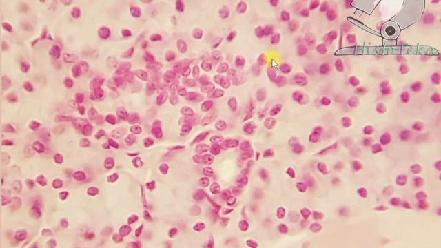 ЛИСТОВИДНЫЕ сосочки языка смотреть онлайн