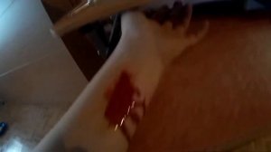 я порезал руку...