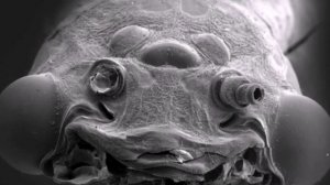 Микробы под микроскопом.