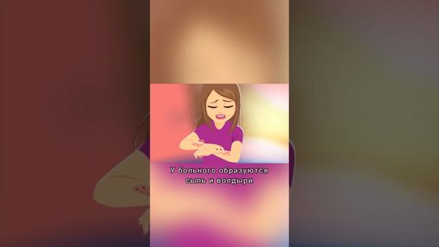 « Аквагенная крапивница» #doctor #рекомендации #факты #аллергия #болезнь #мем #топ #медицина смотреть онлайн