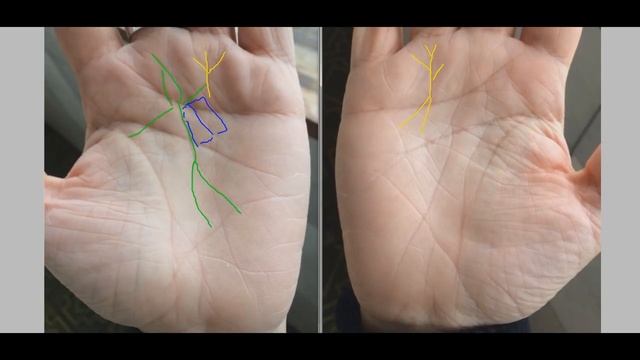 Необычные фигуры на руке. Хиромантия. смотреть онлайн