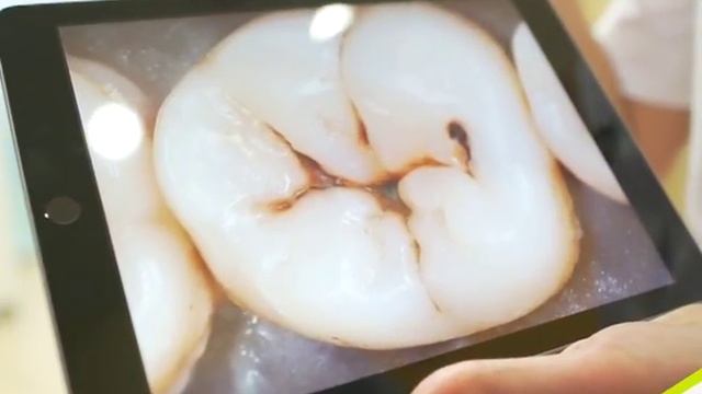 Детская стоматология.