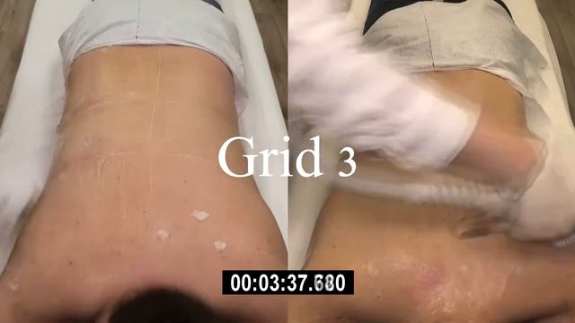 2min Quattro Vs Trio