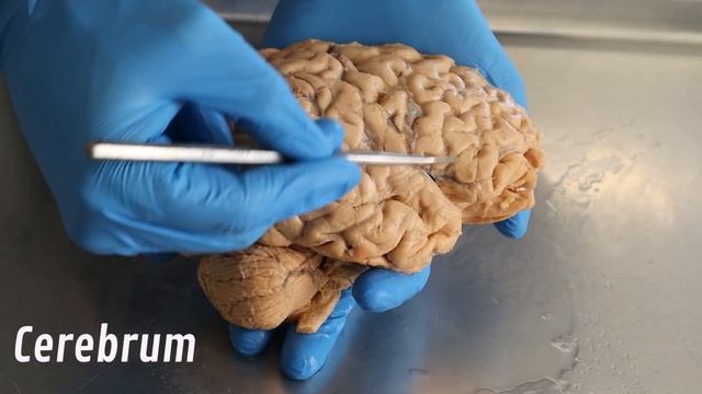 What Are Migraines? смотреть онлайн